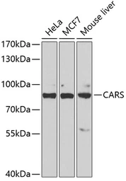 Anti-CARS antibody used in Western Blot (WB). GTX32489