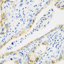 Anti-Cathepsin G antibody used in IHC (Paraffin sections) (IHC-P). GTX32491