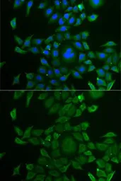 Anti-CCBL1 antibody used in Immunocytochemistry/ Immunofluorescence (ICC/IF). GTX32492