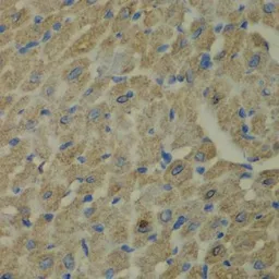 Anti-CCBL1 antibody used in IHC (Paraffin sections) (IHC-P). GTX32492