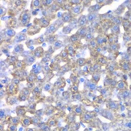 Anti-CCBL1 antibody used in IHC (Paraffin sections) (IHC-P). GTX32492