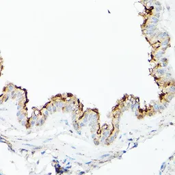 Anti-CD133 antibody used in Immunocytochemistry/ Immunofluorescence (ICC/IF). GTX32496