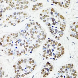Anti-CDX2 antibody used in IHC (Paraffin sections) (IHC-P). GTX32513