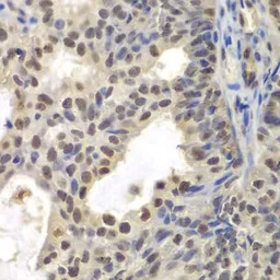 Anti-CENPC antibody used in IHC (Paraffin sections) (IHC-P). GTX32516