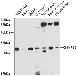 Anti-CHMP1B antibody used in Western Blot (WB). GTX32520