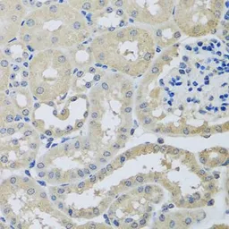 Anti-CHMP1B antibody used in IHC (Paraffin sections) (IHC-P). GTX32520