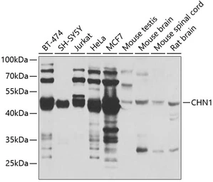Anti-CHN1 antibody used in Western Blot (WB). GTX32521