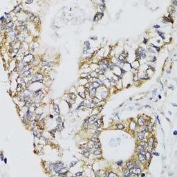 Anti-CHN1 antibody used in IHC (Paraffin sections) (IHC-P). GTX32521