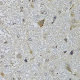 Anti-CHN1 antibody used in IHC (Paraffin sections) (IHC-P). GTX32521