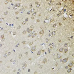 Anti-CHN1 antibody used in IHC (Paraffin sections) (IHC-P). GTX32521