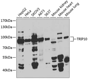 Anti-Cip4 antibody used in Western Blot (WB). GTX32523