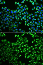 Anti-Citrate synthase antibody used in Immunocytochemistry/ Immunofluorescence (ICC/IF). GTX32524