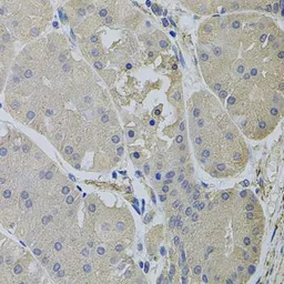 Anti-Clathrin Heavy chain antibody used in IHC (Paraffin sections) (IHC-P). GTX32526