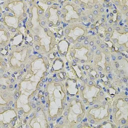 Anti-Clathrin Heavy chain antibody used in IHC (Paraffin sections) (IHC-P). GTX32526