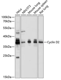 Anti-Cyclin D2 antibody used in Western Blot (WB). GTX32545