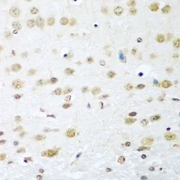 Anti-Cyclin D2 antibody used in IHC (Paraffin sections) (IHC-P). GTX32545