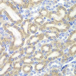 Anti-DAP1 antibody used in IHC (Paraffin sections) (IHC-P). GTX32550
