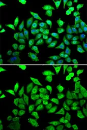 Anti-DBC1 antibody used in Immunocytochemistry/ Immunofluorescence (ICC/IF). GTX32552