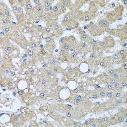 Anti-DCP2 antibody used in IHC (Paraffin sections) (IHC-P). GTX32554