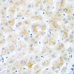 Anti-DHODH antibody used in IHC (Paraffin sections) (IHC-P). GTX32560