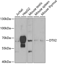 Anti-DTX2 antibody used in Western Blot (WB). GTX32566