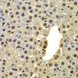 Anti-DTX2 antibody used in IHC (Paraffin sections) (IHC-P). GTX32566