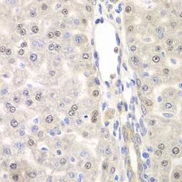 Anti-DTX2 antibody used in IHC (Paraffin sections) (IHC-P). GTX32566