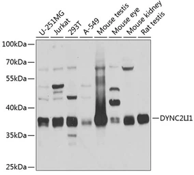 Anti-DYNC2LI1 antibody used in Western Blot (WB). GTX32569