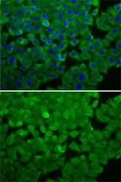 Anti-eEF2K antibody used in Immunocytochemistry/ Immunofluorescence (ICC/IF). GTX32573