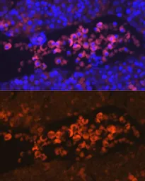 Anti-EPO receptor antibody used in IHC (Paraffin sections) (IHC-P). GTX32590