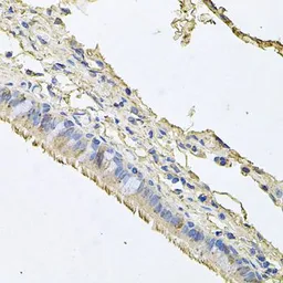 Anti-EPO receptor antibody used in IHC (Paraffin sections) (IHC-P). GTX32590