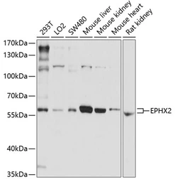 Anti-EPXH2 antibody used in Western Blot (WB). GTX32591