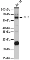 Anti-FLIP antibody used in Western Blot (WB). GTX32608