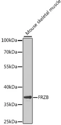 Anti-FRP-3 antibody used in Western Blot (WB). GTX32611