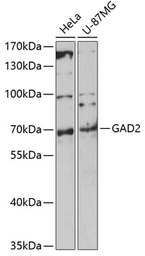Anti-GAD65 antibody used in Western Blot (WB). GTX32615