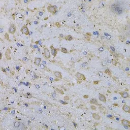 Anti-GAD65 antibody used in IHC (Paraffin sections) (IHC-P). GTX32615