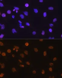 Anti-GADD153 antibody used in Immunocytochemistry/ Immunofluorescence (ICC/IF). GTX32616
