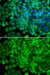 Anti-Galactosidase alpha antibody used in Immunocytochemistry/ Immunofluorescence (ICC/IF). GTX32617