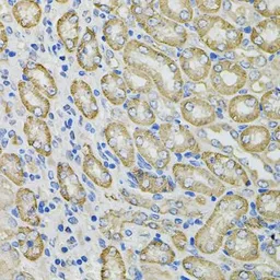 Anti-Galactosidase alpha antibody used in IHC (Paraffin sections) (IHC-P). GTX32617