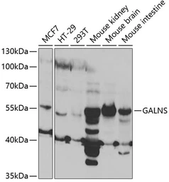Anti-GALNS antibody used in Western Blot (WB). GTX32618