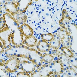 Anti-GDAP1 antibody used in IHC (Paraffin sections) (IHC-P). GTX32623