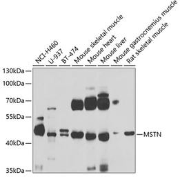 Anti-GDF8 / Myostatin antibody used in Western Blot (WB). GTX32624