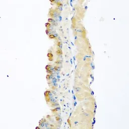 Anti-GDF8 / Myostatin antibody used in IHC (Paraffin sections) (IHC-P). GTX32624