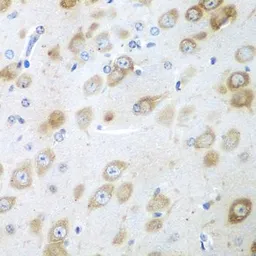Anti-GFM1 antibody used in IHC (Paraffin sections) (IHC-P). GTX32625