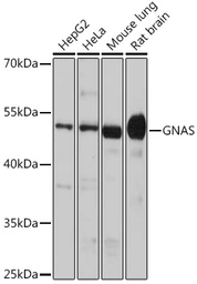 Anti-GNAS antibody used in Western Blot (WB). GTX32629