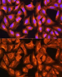 Anti-GNAS antibody used in Immunocytochemistry/ Immunofluorescence (ICC/IF). GTX32629