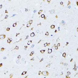 Anti-Grp78 antibody used in IHC (Paraffin sections) (IHC-P). GTX32636