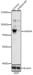 Anti-HADHA antibody used in Western Blot (WB). GTX32642