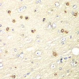 Anti-HIF1AN antibody used in IHC (Paraffin sections) (IHC-P). GTX32652