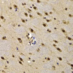 Anti-HMG20A antibody used in IHC (Paraffin sections) (IHC-P). GTX32655